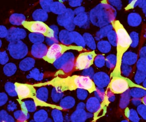 mCherry (chicken antibody) in the group Tag Antibodies / GFP/YFP/RFP/CFP at Agrisera AB (Antibodies for research) (AS18 4178)